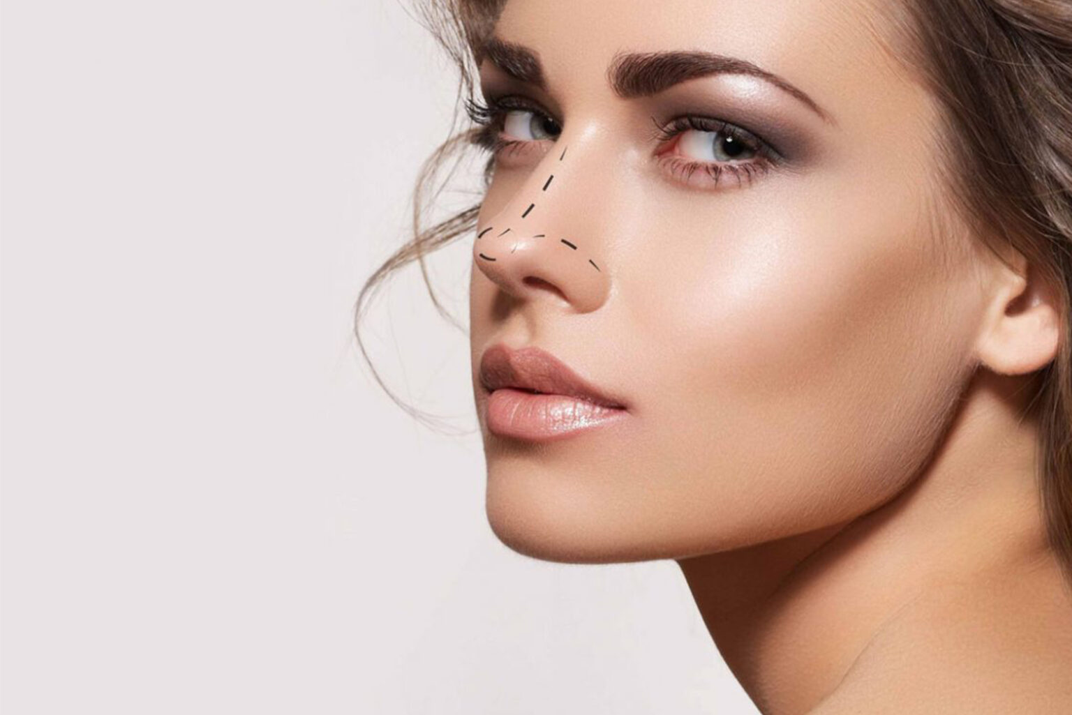Rhinoplasty What You Need to Know About Nasal Aesthetics
