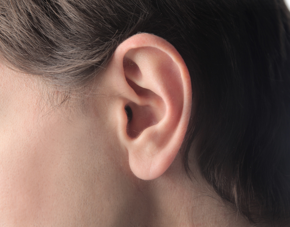 Prominent Ear Surgery (Otoplasty)